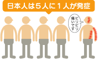 ５人に１人が発症