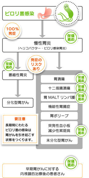 ピロリ菌が原因となる病気