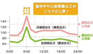 グラフ 脳卒中や心筋梗塞などのリスクが上昇