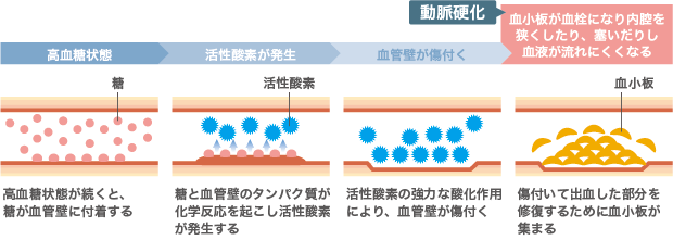 糖尿病が血管に障害を及ぼすメカニズム