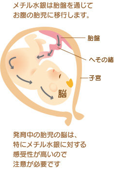 メチル水銀は胎盤を通じてお腹の胎児に移行します