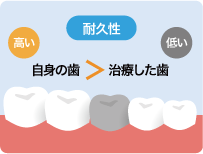 自身の歯>治療した歯の耐久性