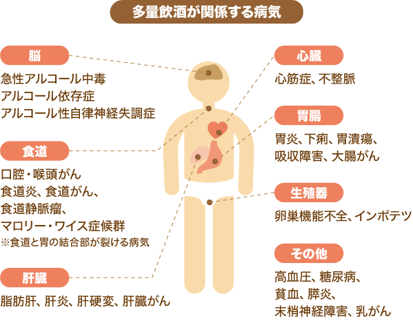 多量飲酒が全身に引き起こす様々な病気