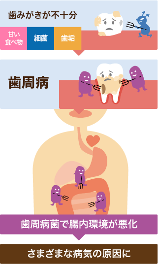 歯周病と腸内環境