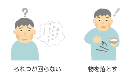 ろれつがまわらない・物を落とす