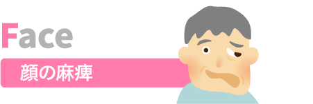 顔の麻痺