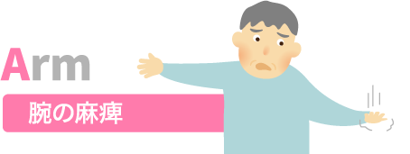 腕の麻痺