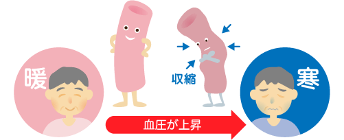 夏と冬の血管