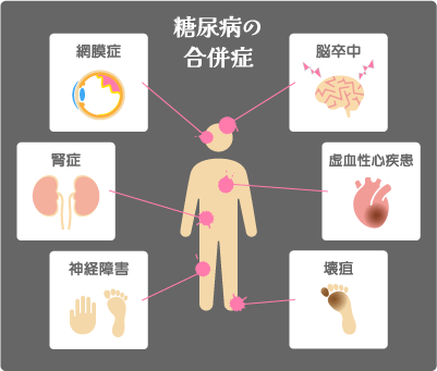 糖尿病の合併症